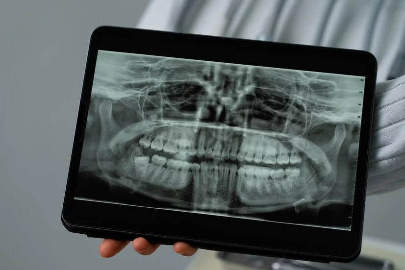 XRAYS / IMAGING